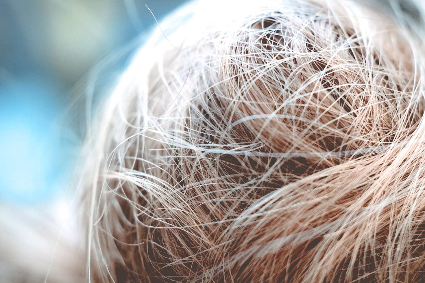 Natürliche Ergebnisse dank moderner Haartransplantation